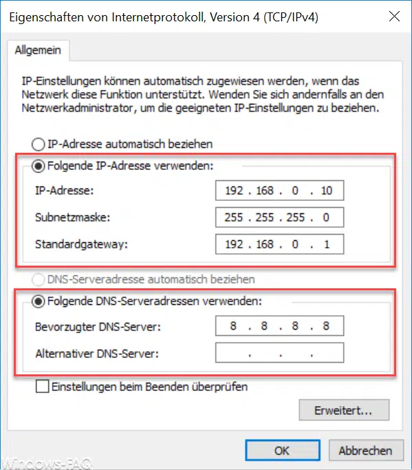 Feste IP Adresse festlegen